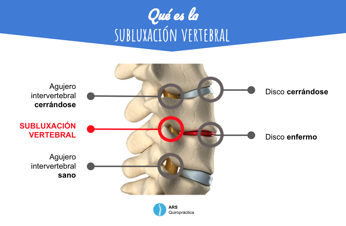 Qué significa tener una columna vertebral sana